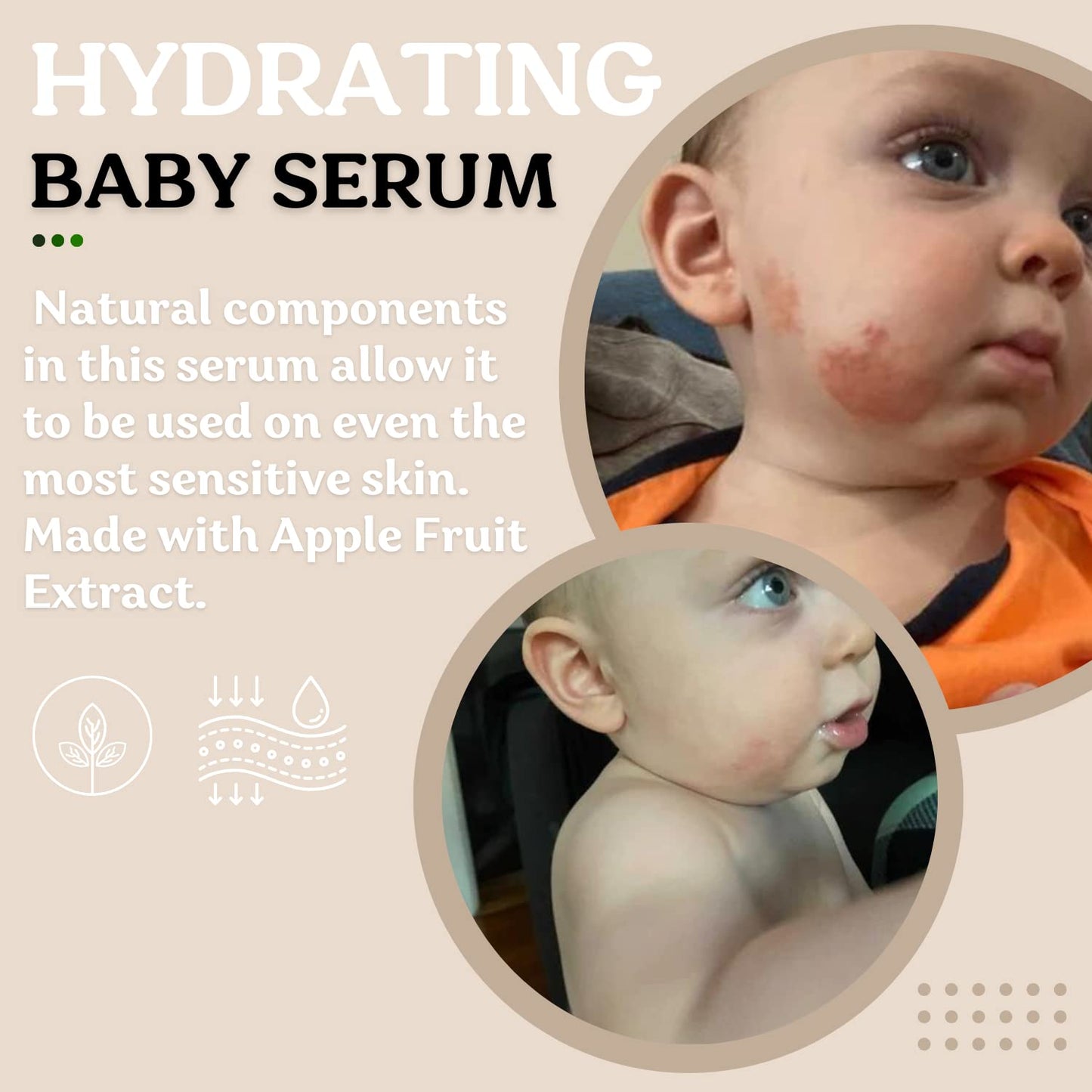 Roe Wellness- Baby Serum Hydrating Skincare Probiotic Protection | Hydrate, Soothe, Clean