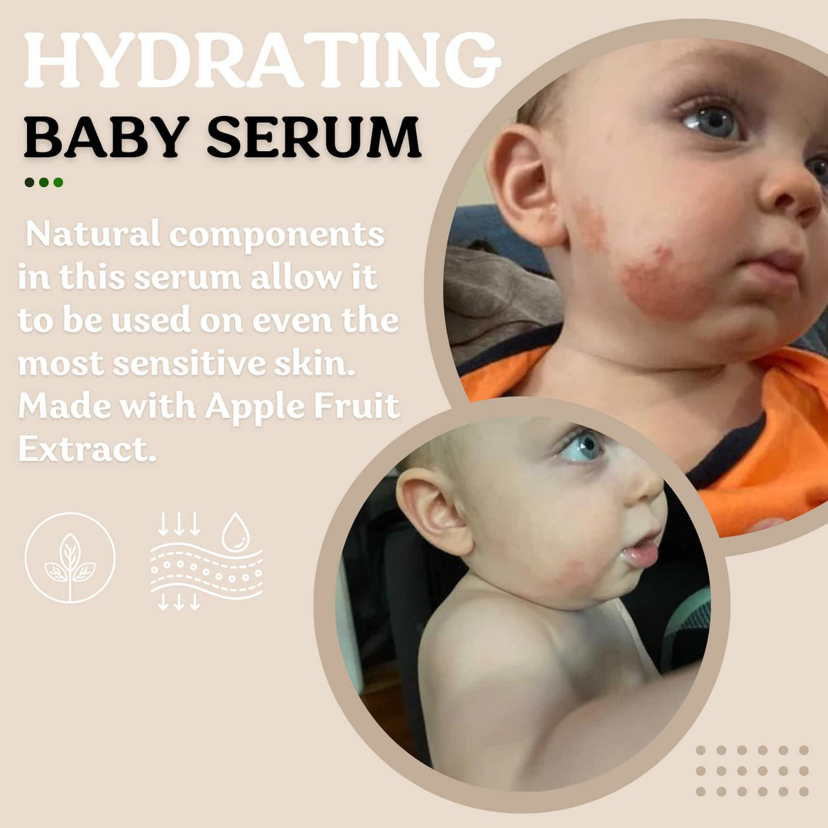 Roe Wellness- Baby Serum Hydrating Skincare Probiotic Protection | Hydrate, Soothe, Clean