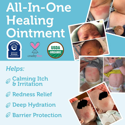 Era Organics Healing Ointment for Babies - USDA Certified Organic Natural Moisturizer Gentle on