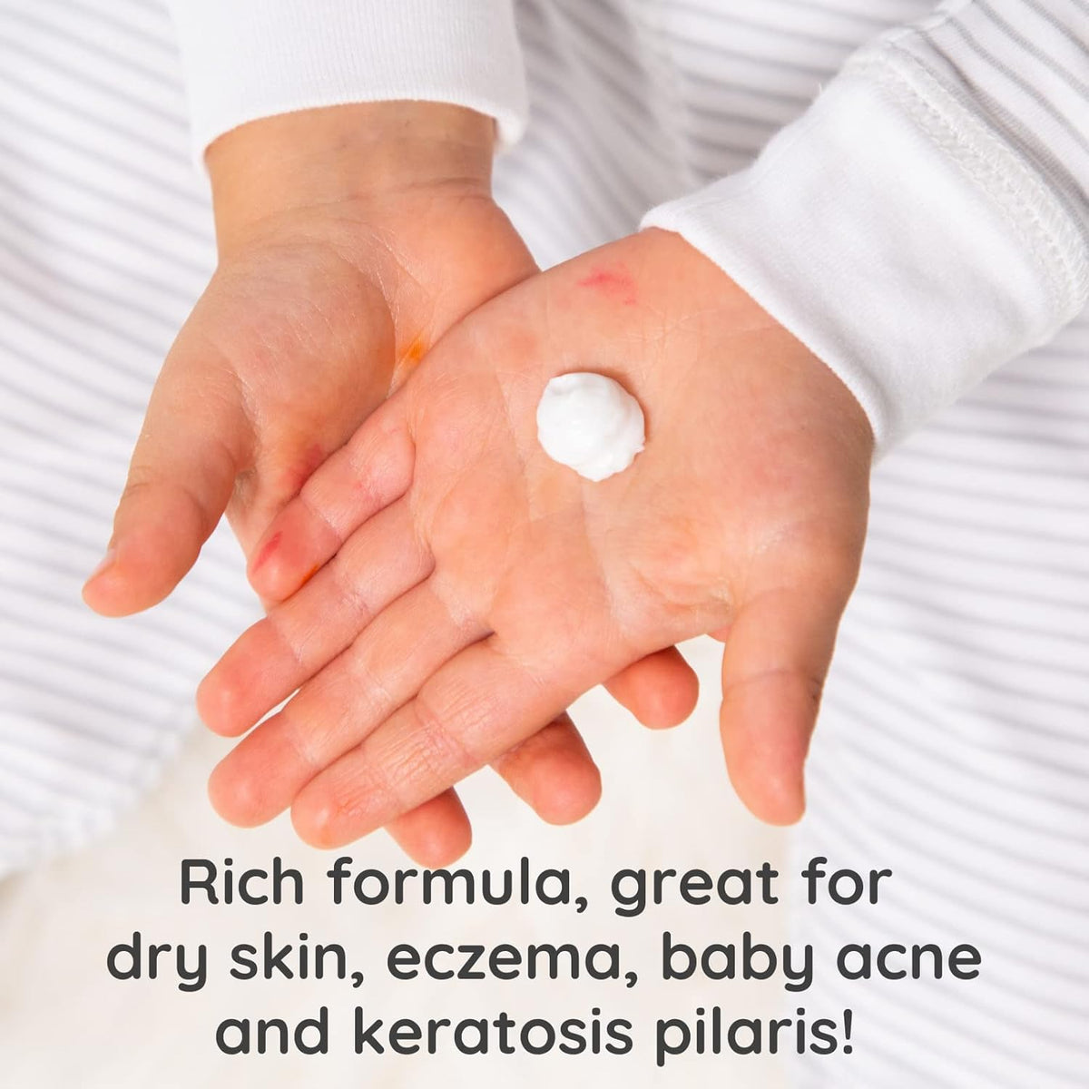 Bubbsi Whipped Coconut Oil Baby Lotion for Eczema, Dry Skin, Baby Acne, KP | Organic Coconut Oil
