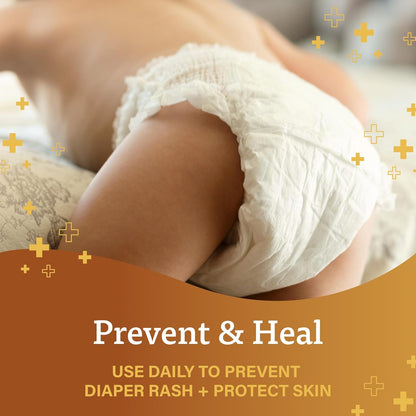 A+D Original Diaper Rash Ointment, Prevents & Protects Diaper Rash, Moisturizes & Heals Dry Skin