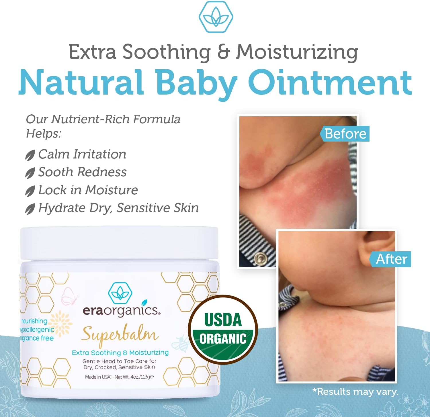 Era Organics Healing Ointment for Babies - USDA Certified Organic Natural Moisturizer Gentle on