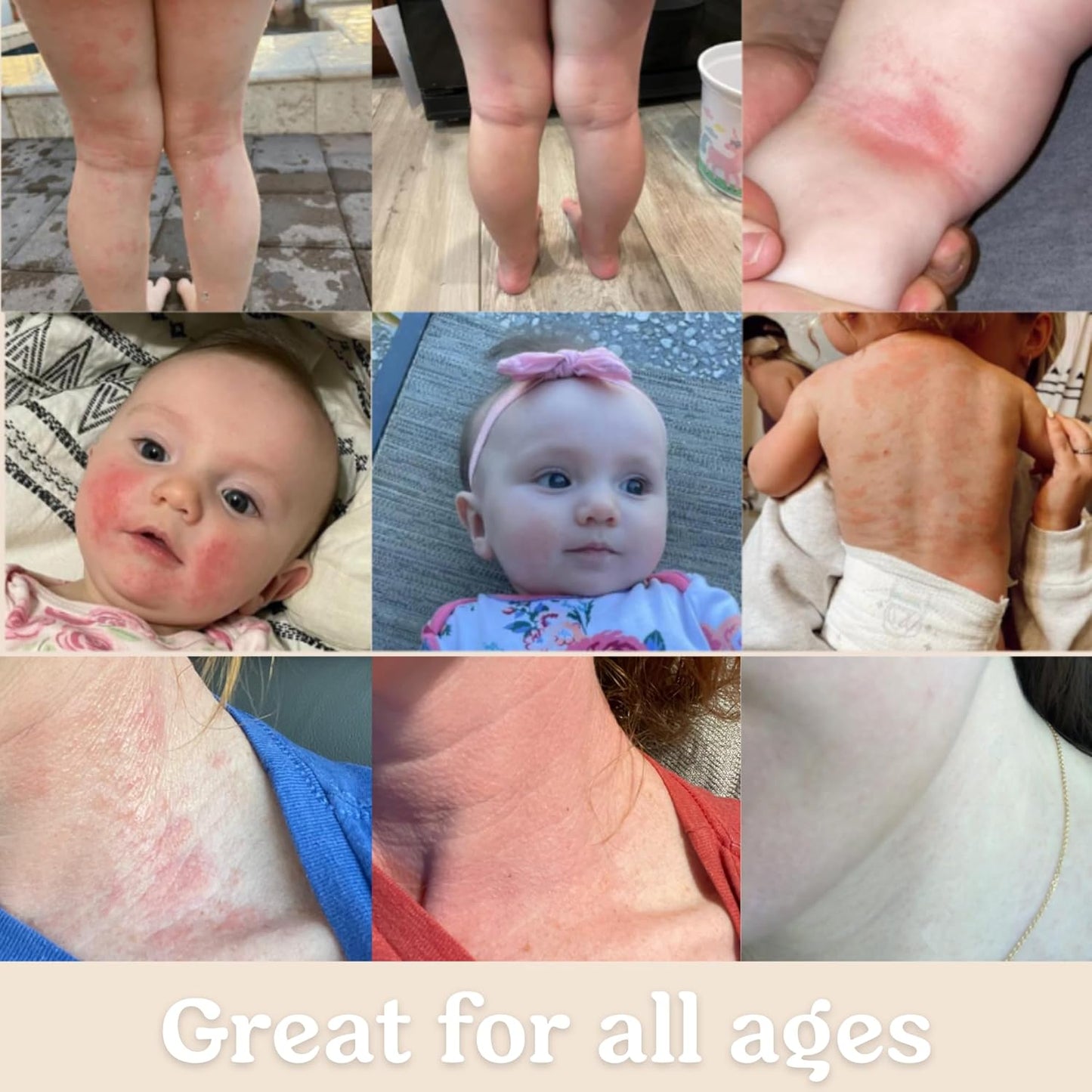 Baby Cream & Baby Serum Power Pair Biome Barrier | For All Skin & Ages | Hydrating Body, Face, Dry